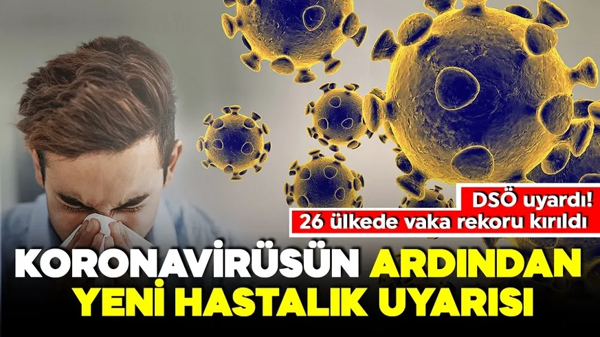 M çiçeği virüsü vakalarında artış yaşanıyor!