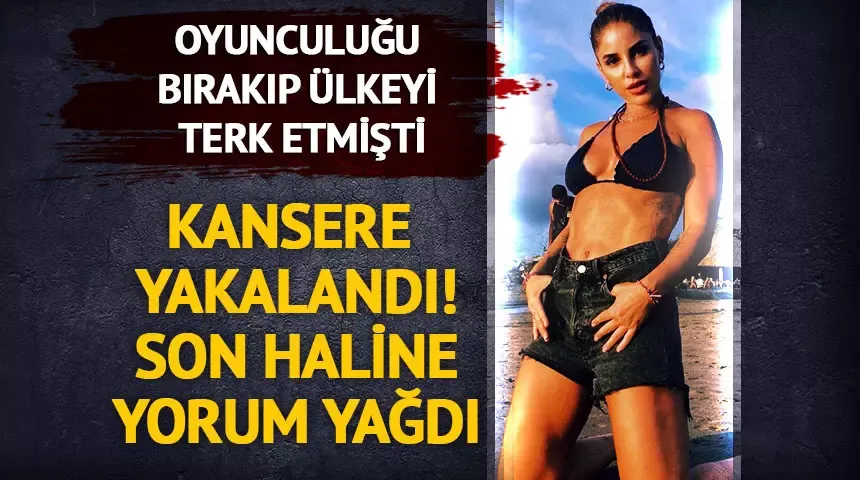 Oyunculuğu bırakıp ülkeyi terk etmişti! Irmak Ünal kansere yakalandı! Saçlarını kısacık kestirdi son haline yorum yağdı