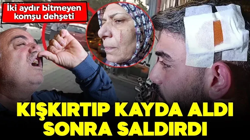 Komşuları tarafından darp edildiler; babanın dişleri kırıldı, anne ile oğlu bıçaklandı