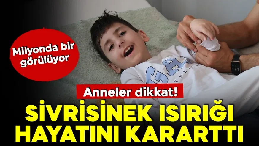 Milyonda bir görülüyor! Sivrisinek ısırığı hayatını kararttı...