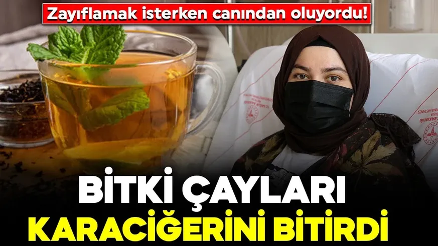 Zayıflamak isterken canından oluyordu! Bitki çayları karaciğerini bitirdi...