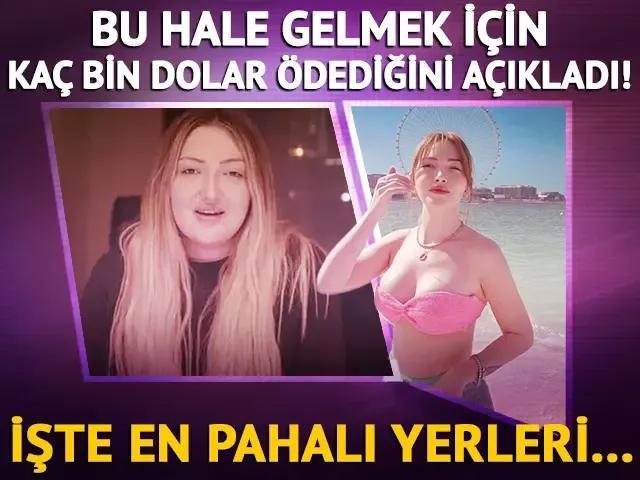 Danla Bilic 300 bin dolar ödeyip bambaşka biri oldu! Pahalı olan yerleri