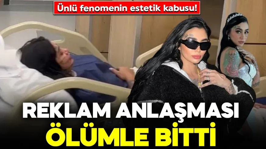 Ünlü fenomenin estetik kabusu! Reklam anlaşması ölümle bitti